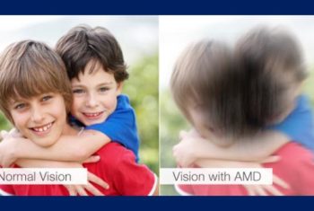 AMD vision